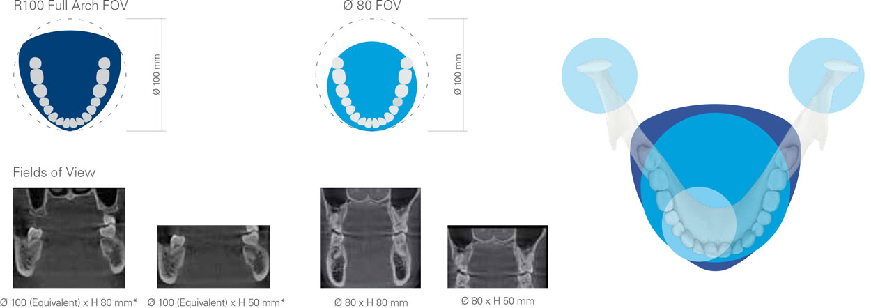 Seacoast Dental Centre's Veraview 3D CT Scanner offers a variety of ways to look at your teeth